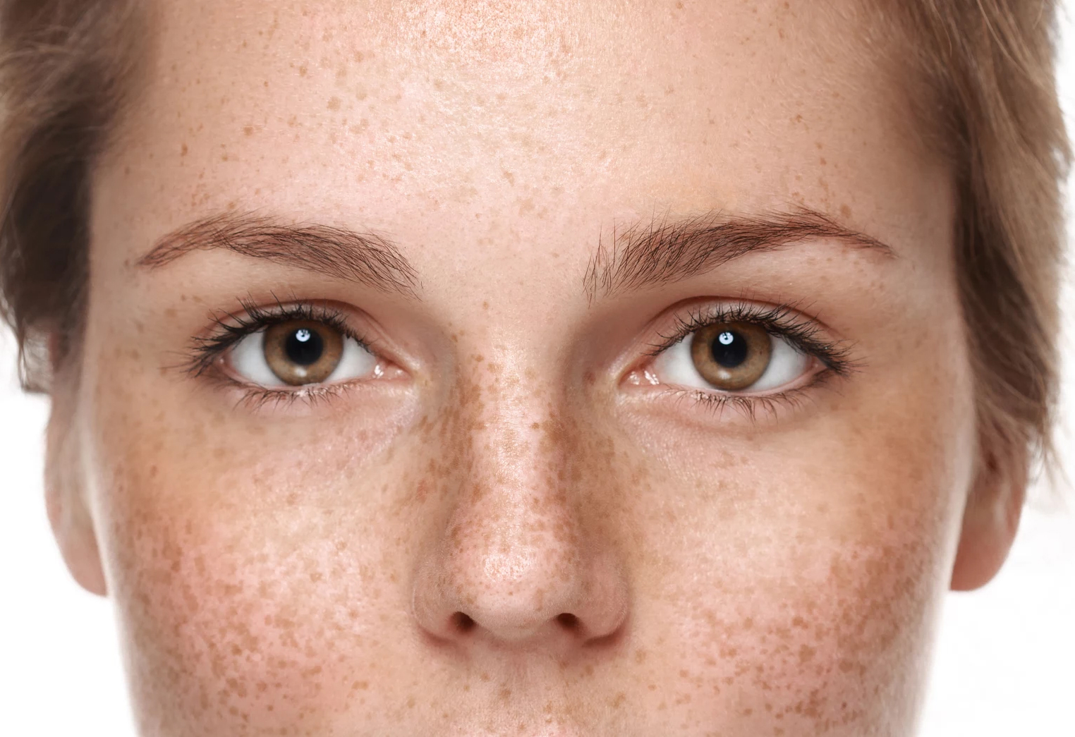 How Do I Get Rid of Brown Spots? Reversing Photo Aging